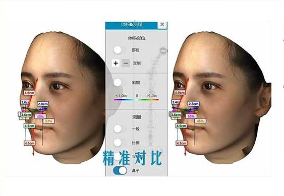 整形美容APP開(kāi)發(fā)